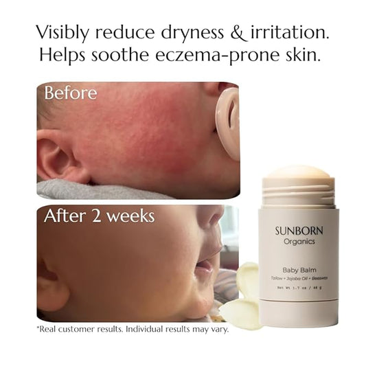 Baby Balm | Baby-Safe Three Natural Ingredient Moisturizing Balm for Babies (Dry Skin, Diaper Rash & Eczema Relief) – Petroleum-Free, Fragrance/Essential Oil-Free, Third-party Lab-tested, All Natural