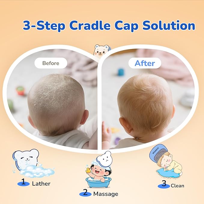 Cloud Baby Cradle Cap Brush & Baby Comb Set, 3-in-1 Cradle Cap Treatment with Soft Brush, Hair Comb & Bath Sponge, BPA-Free, Easy to Use | Infant Bath Essentials - Extra Sponge, Serene Green